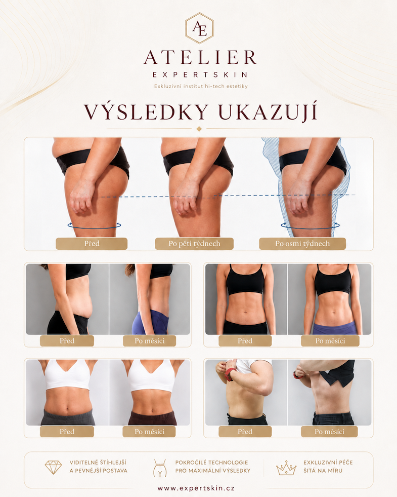 Výsledky tělové péče Atelier Expertskin — srovnání před a po